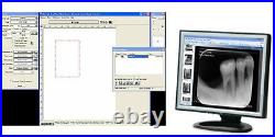New! Microtek Medi 2200 Plus High Speed Dental X Ray Scanner Dental Digitizer